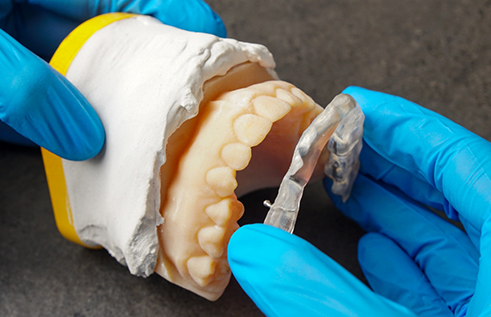 Dentist holding a model of the jaws with a clear tray over one arch of teeth